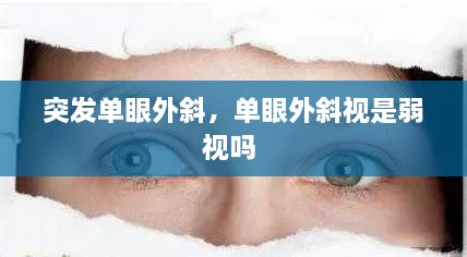 突发单眼外斜，单眼外斜视是弱视吗 