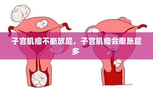 子宫肌瘤不断放屁，子宫肌瘤会腹胀屁多 